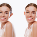 Otoplastia: 5 Indicações, Como É a Cirurgia e a Recuperação